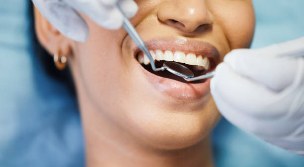 Best Broken or Chipped Tooth Repair in Salem, AR